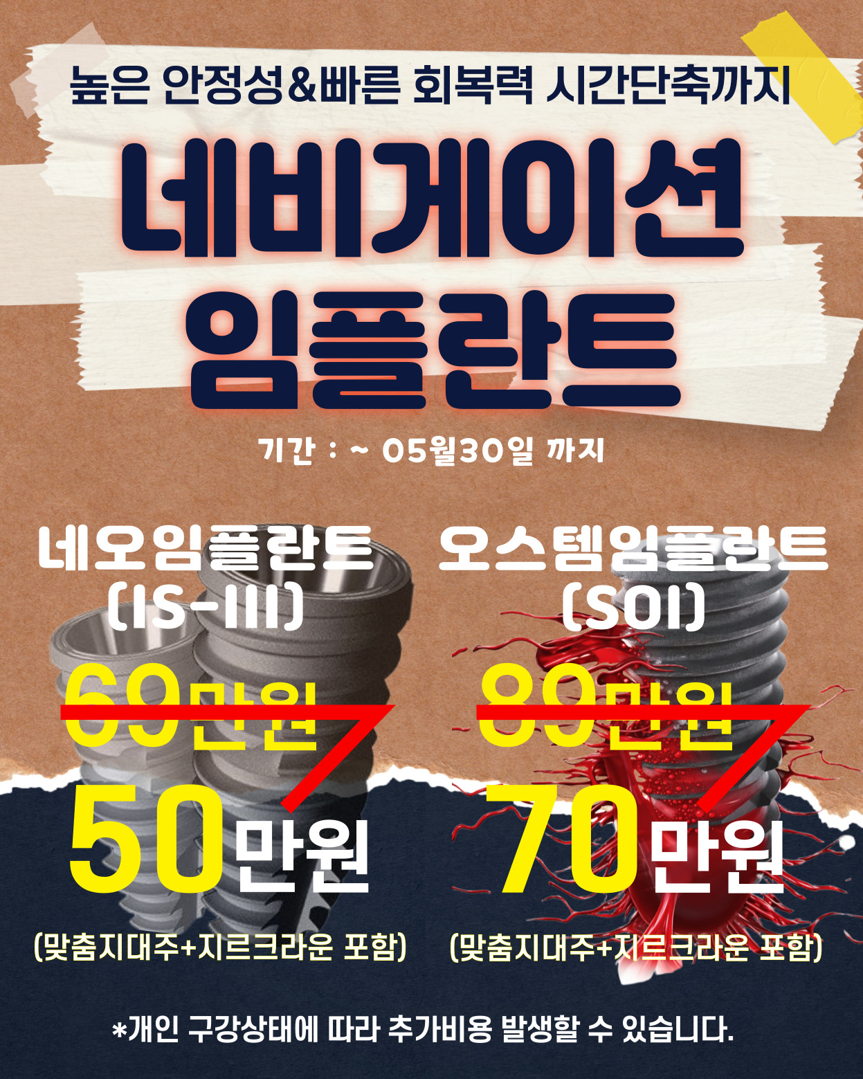 팝업2